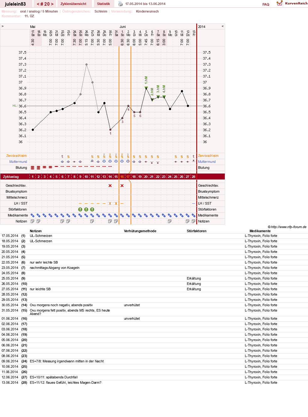 NFP-Kurve User #16057