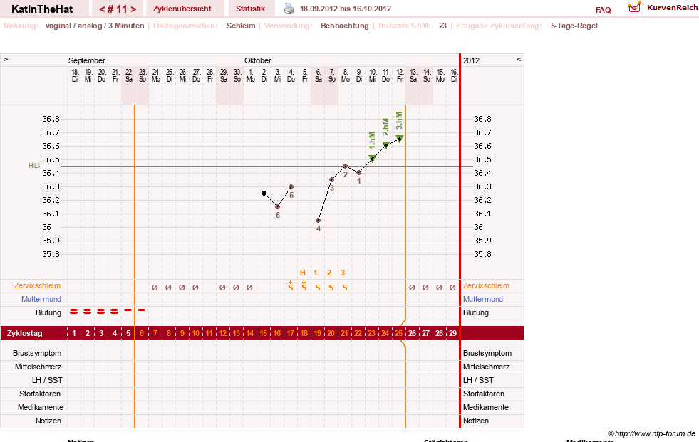 NFP-Kurve User #16123