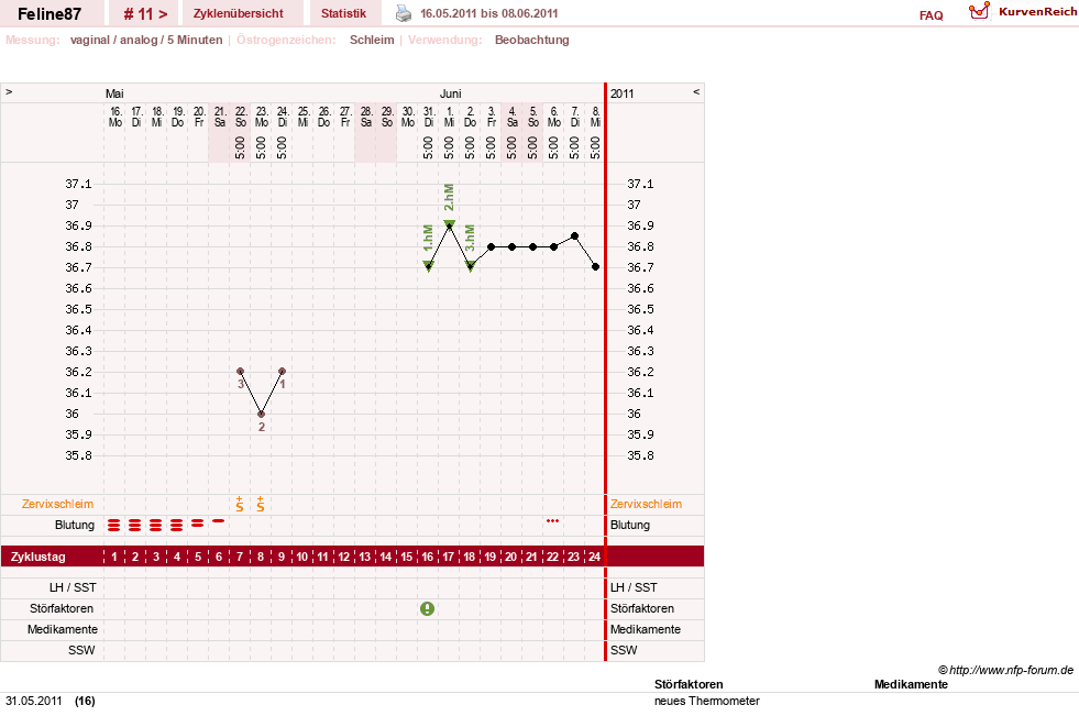 NFP-Kurve User #16144