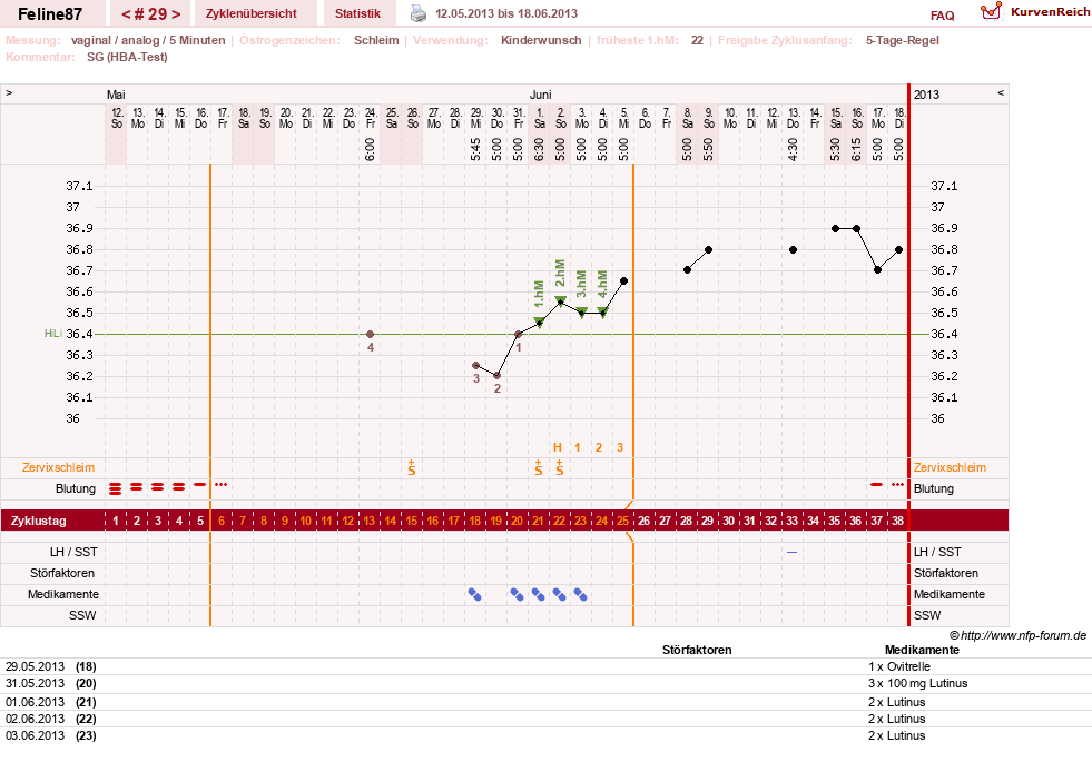 NFP-Kurve User #16144