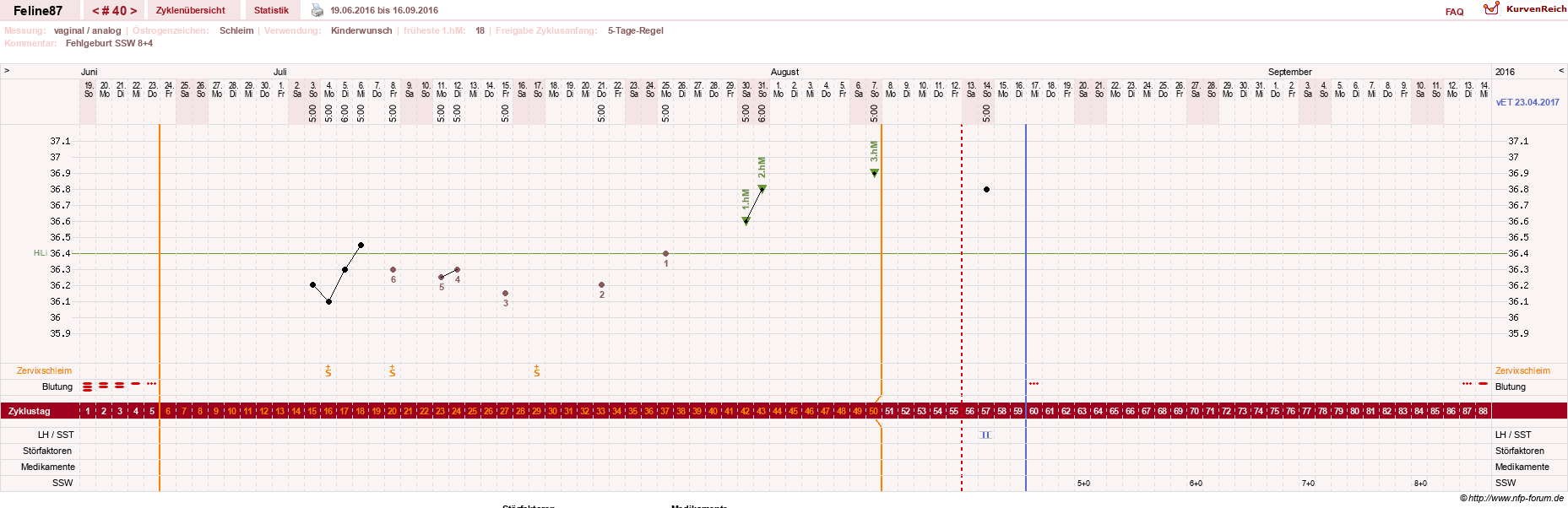NFP-Kurve User #16144