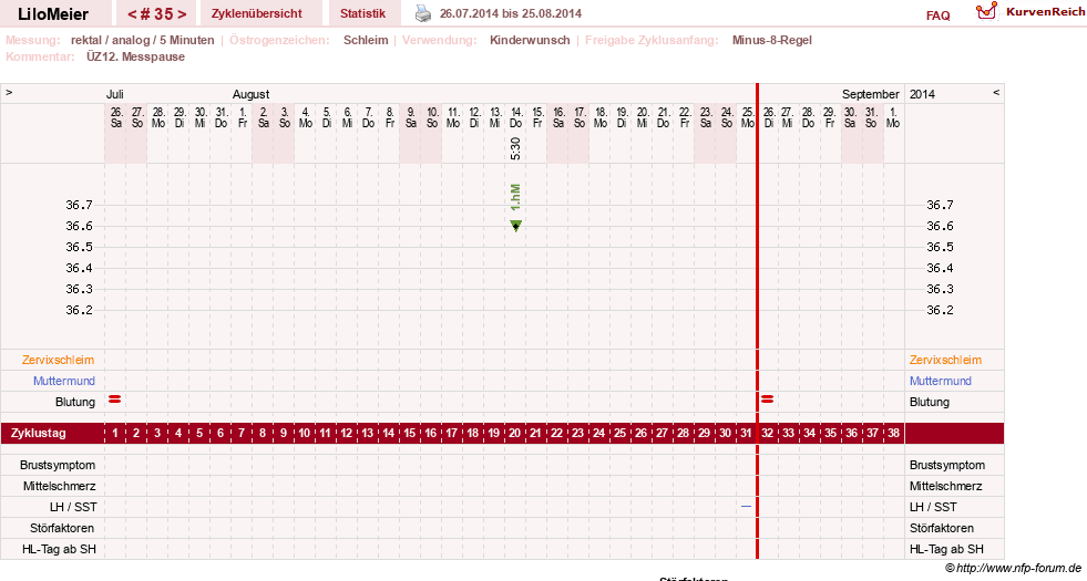 NFP-Kurve User #16324