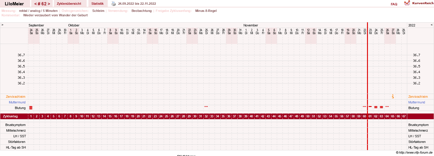 NFP-Kurve User #16324