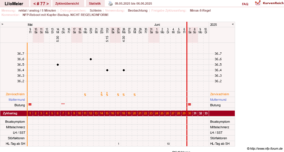 NFP-Kurve User #16324