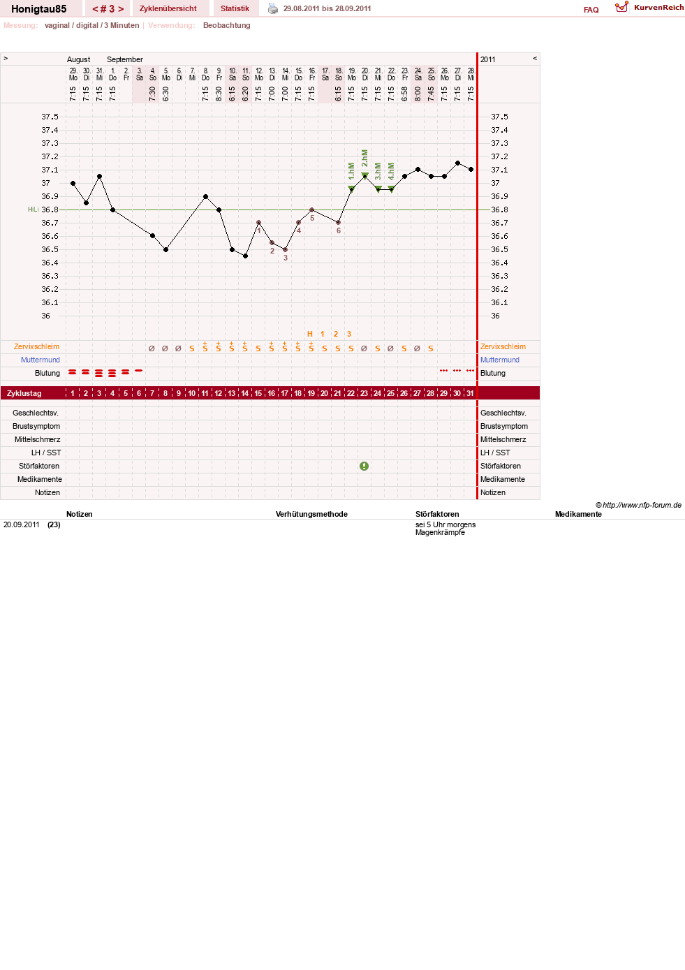 NFP-Kurve User #16383