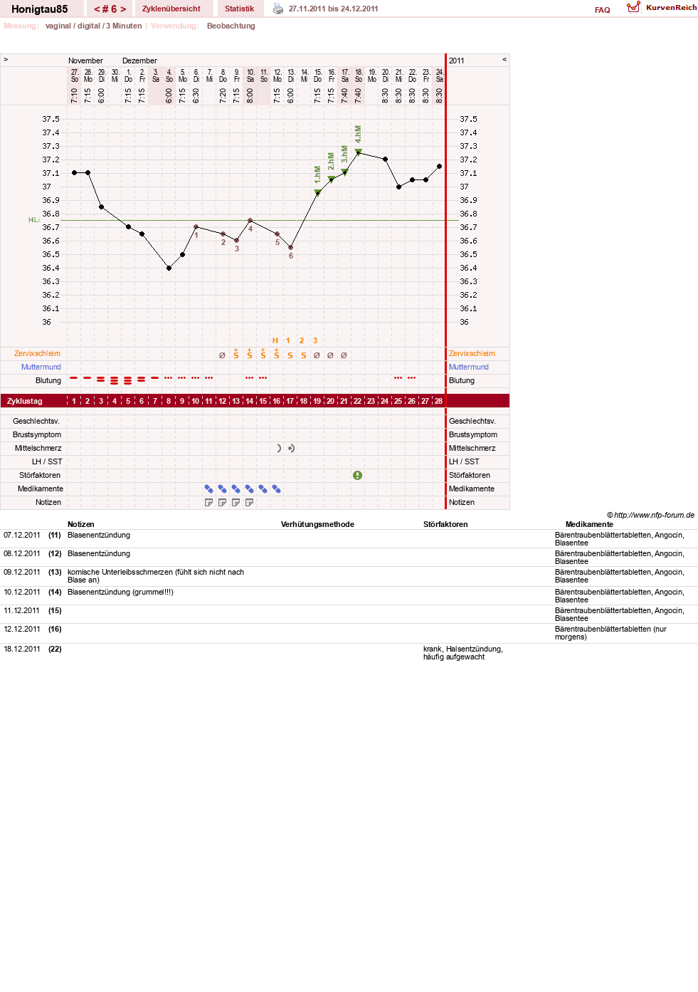 NFP-Kurve User #16383