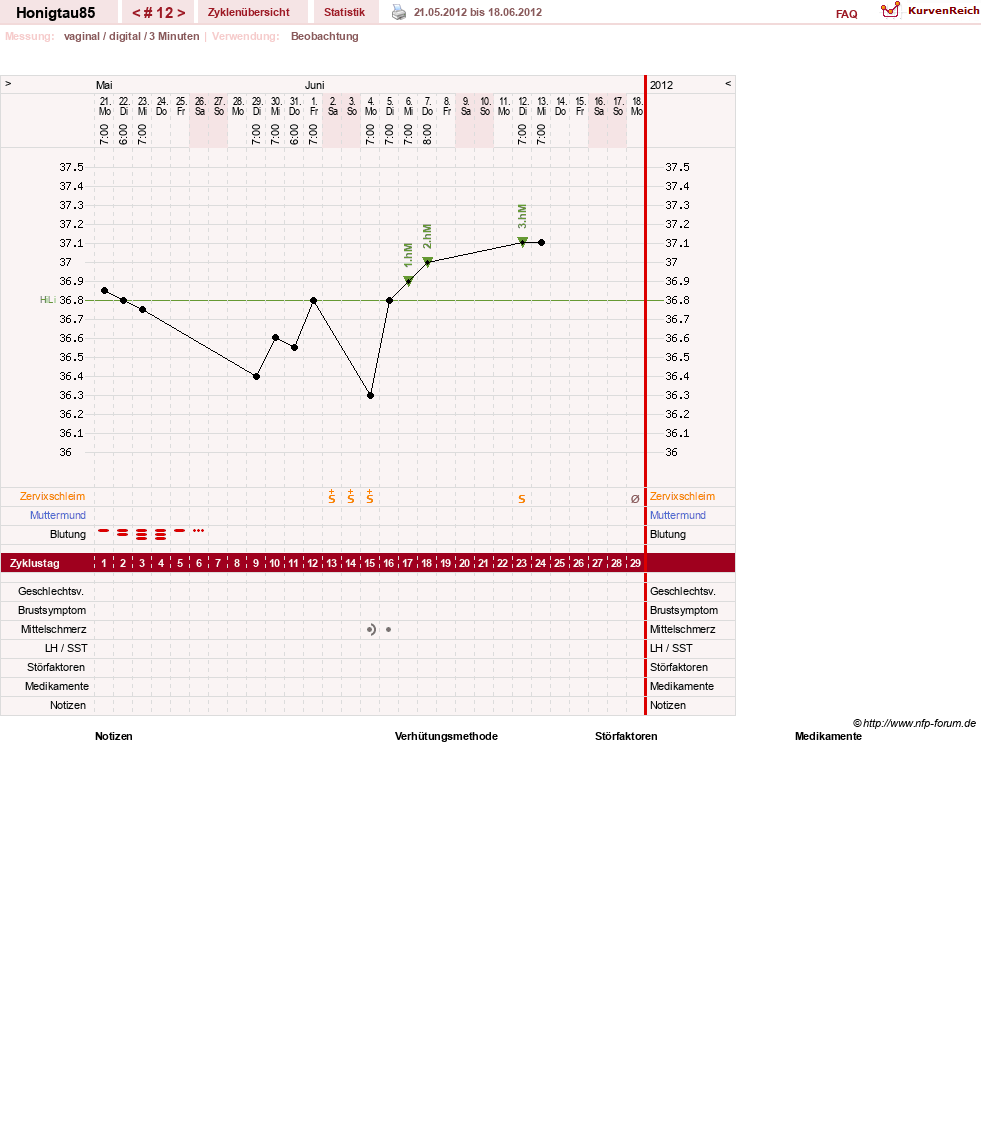 NFP-Kurve User #16383