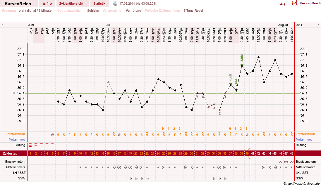 NFP-Kurve User #16457