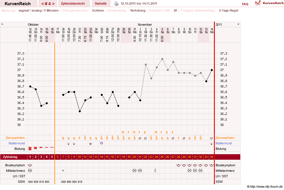 NFP-Kurve User #16457