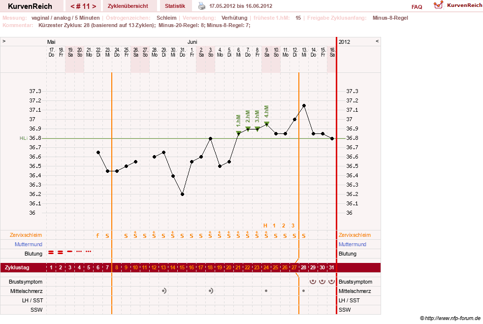 NFP-Kurve User #16457