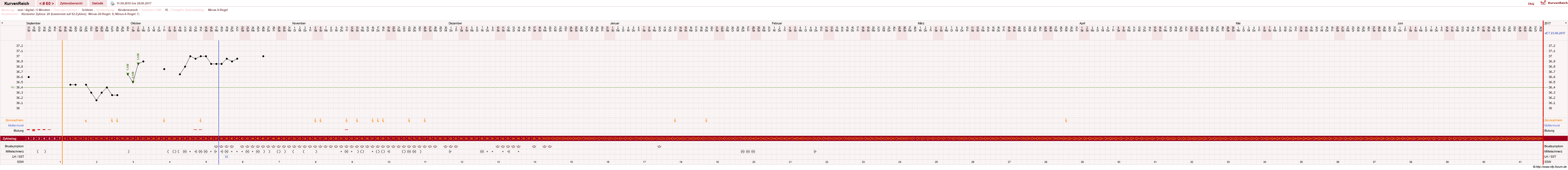 NFP-Kurve User #16457