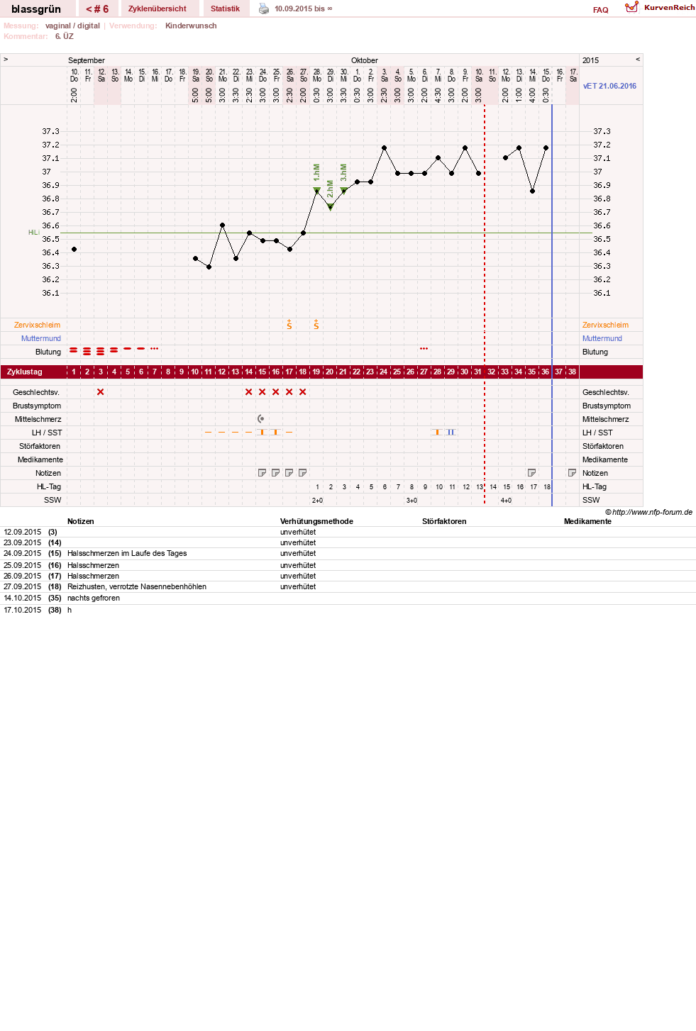 NFP-Kurve User #16486