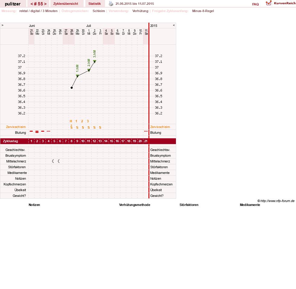 NFP-Kurve User #16497