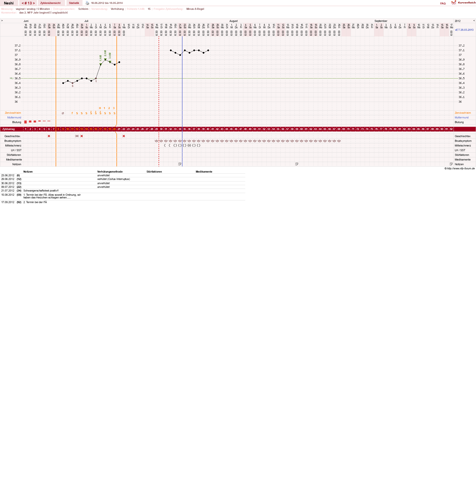NFP-Kurve User #16531