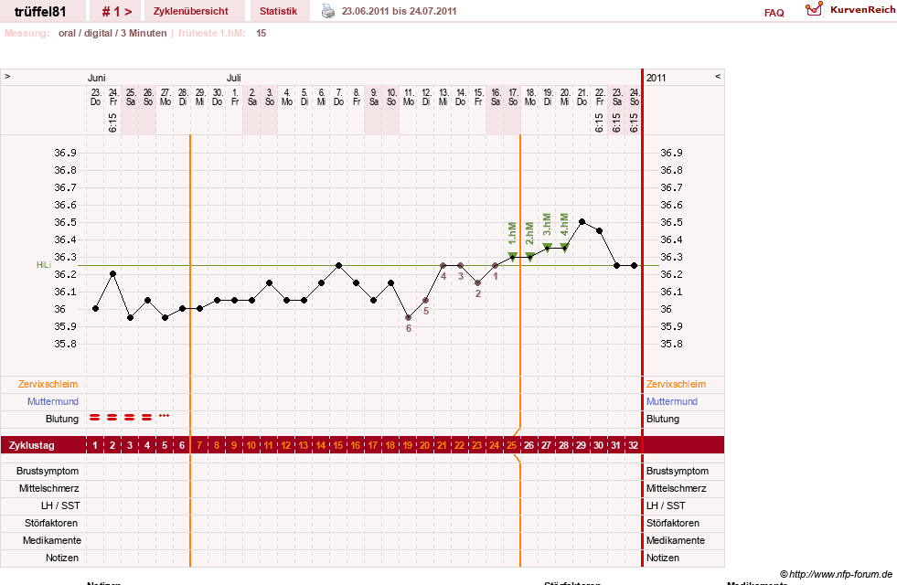 NFP-Kurve User #16631