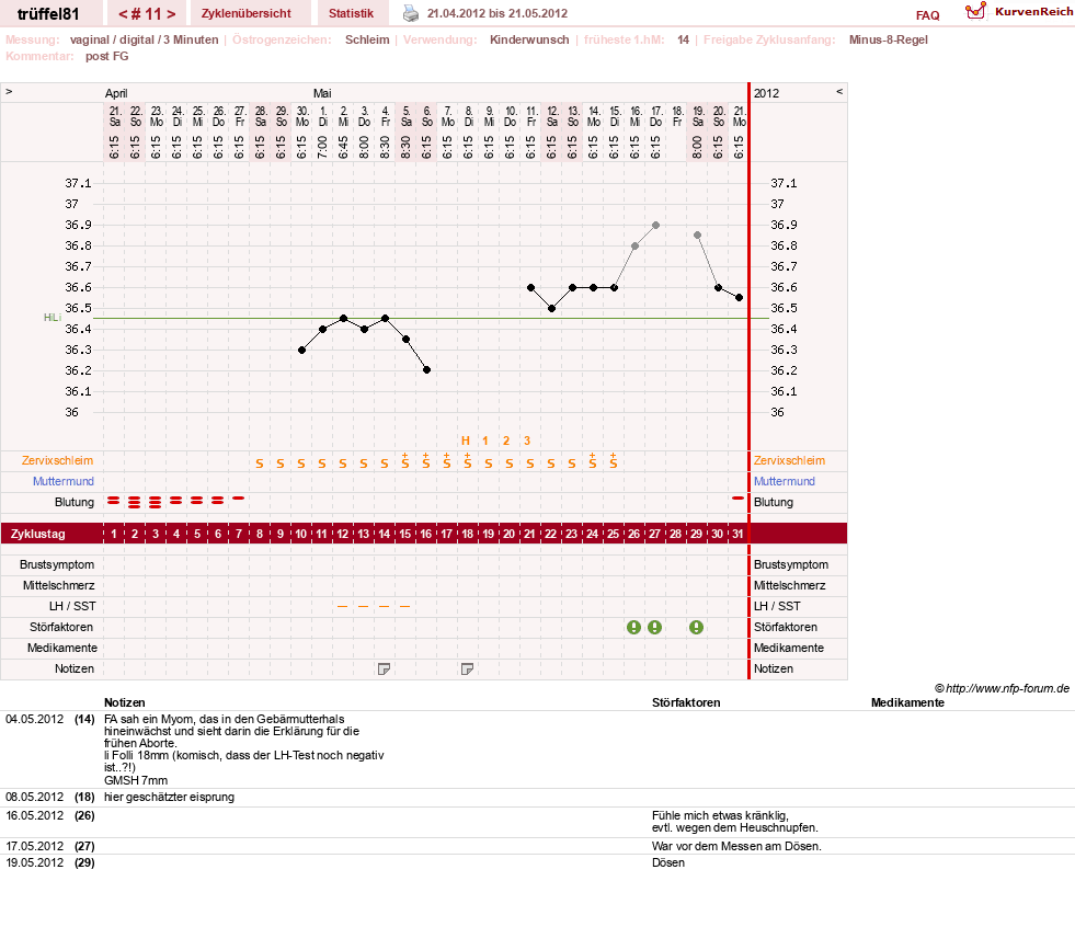 NFP-Kurve User #16631