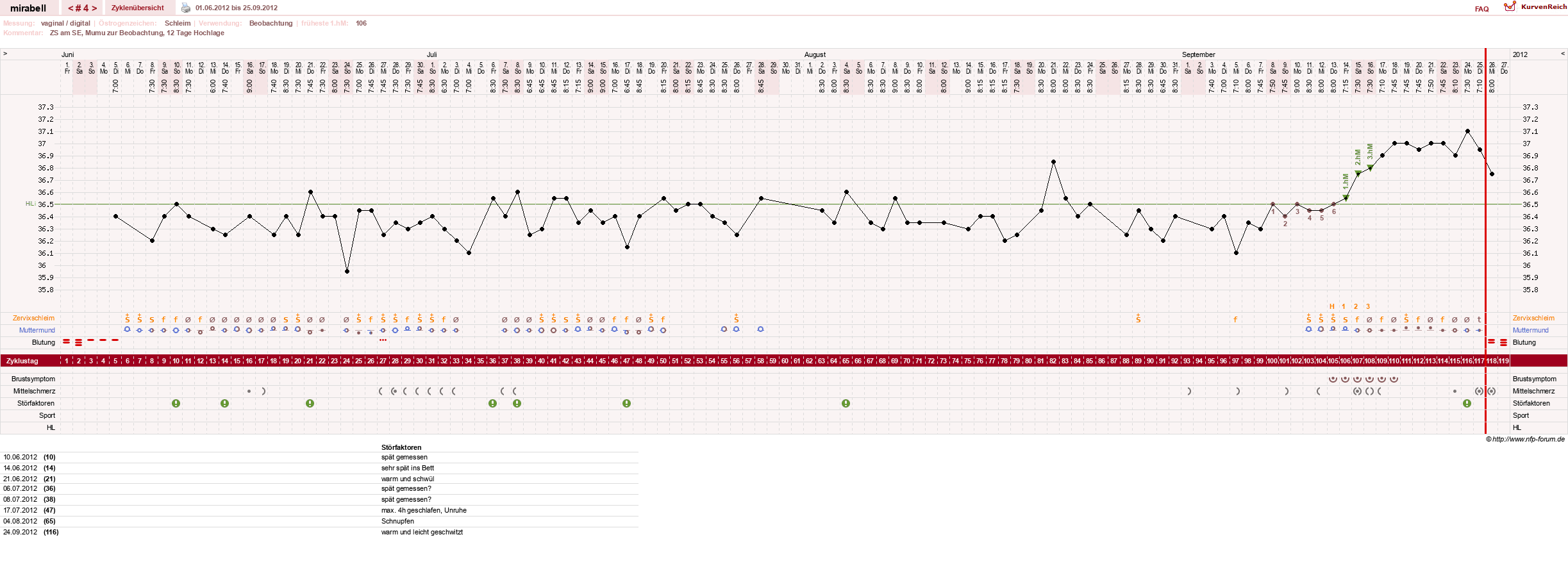 NFP-Kurve User #16685