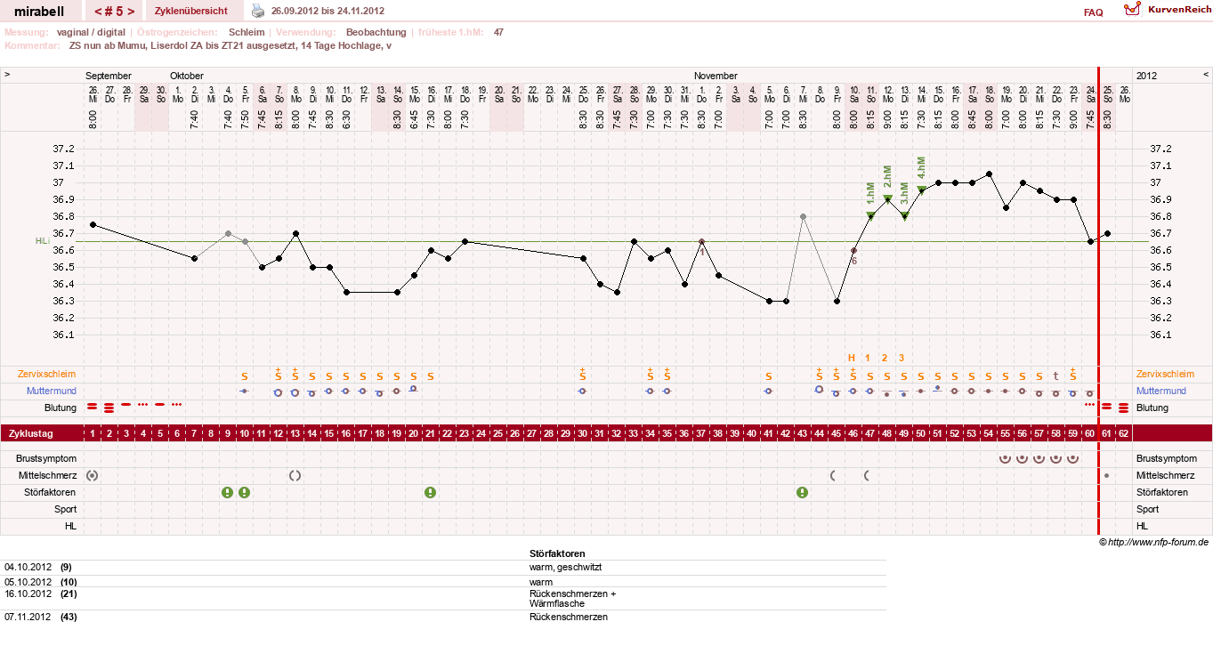 NFP-Kurve User #16685