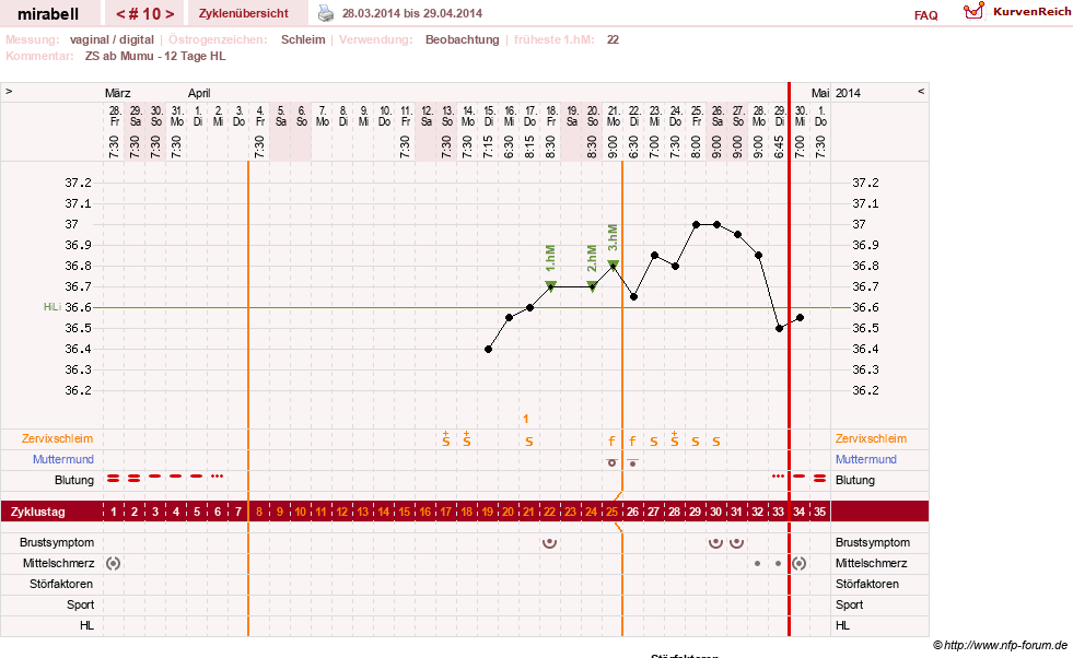 NFP-Kurve User #16685