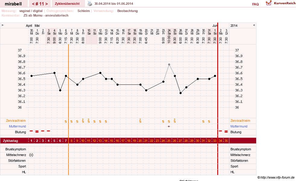 NFP-Kurve User #16685