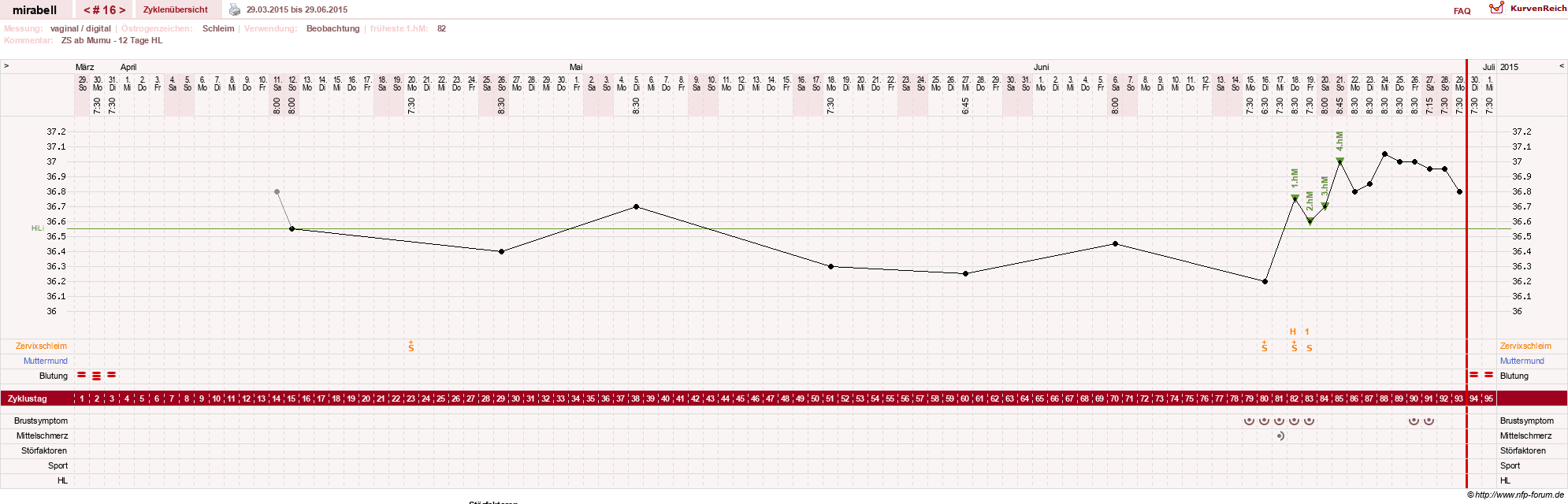 NFP-Kurve User #16685