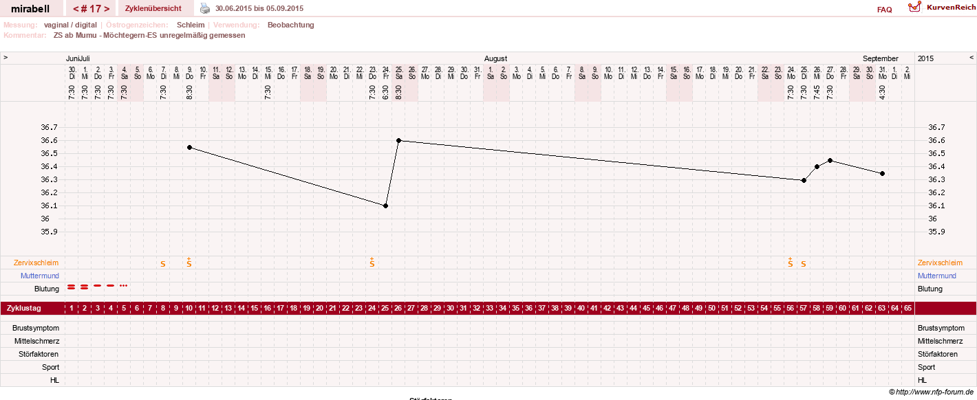 NFP-Kurve User #16685