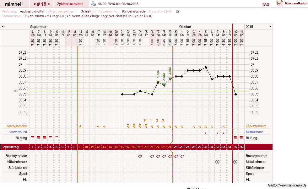 NFP-Kurve User #16685