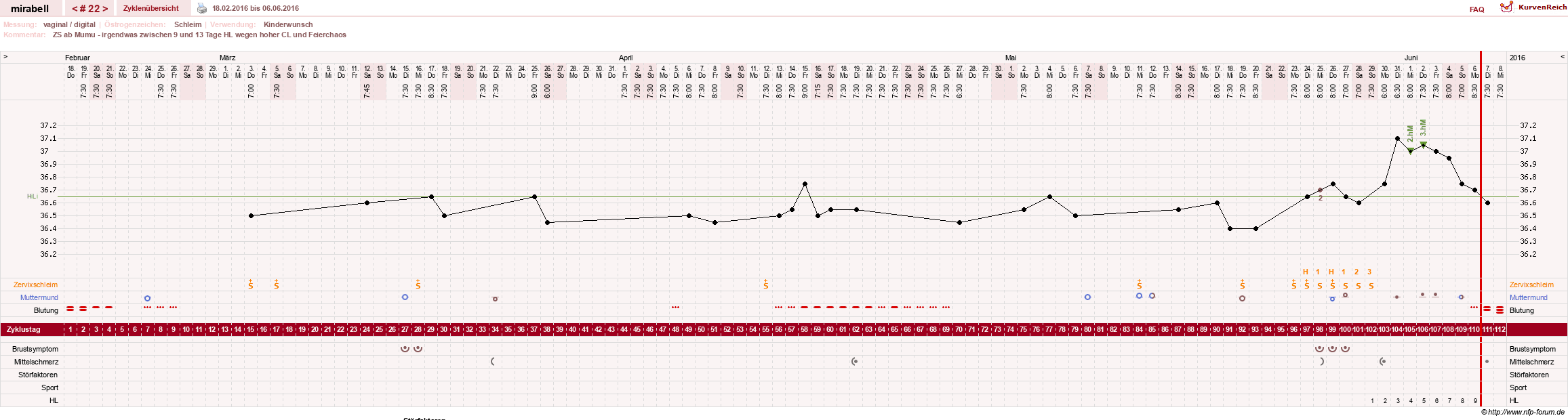 NFP-Kurve User #16685