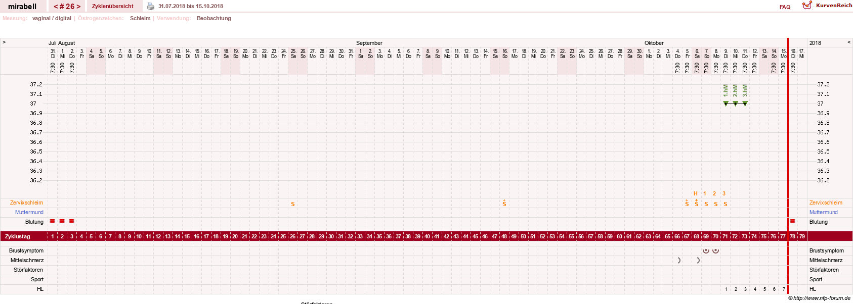 NFP-Kurve User #16685