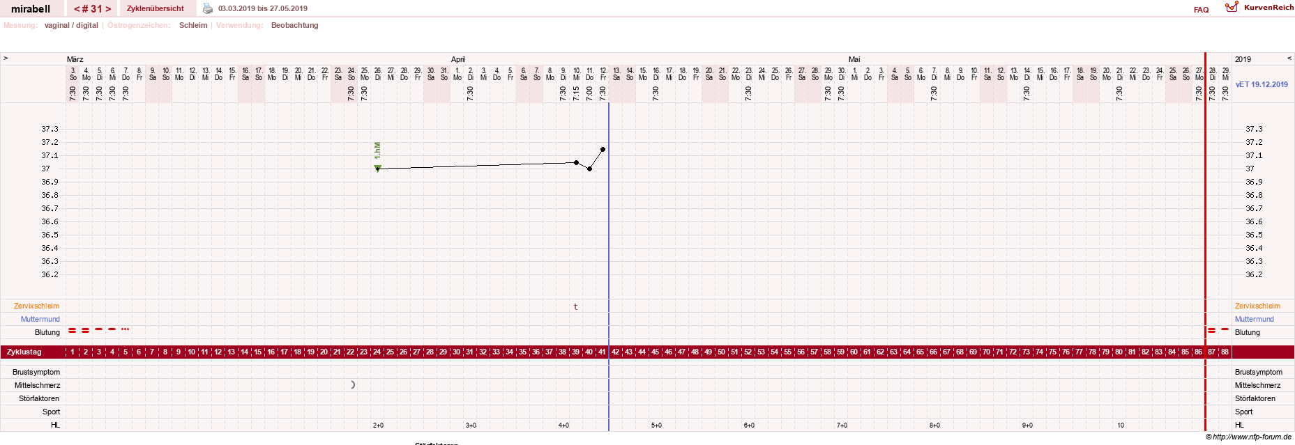 NFP-Kurve User #16685