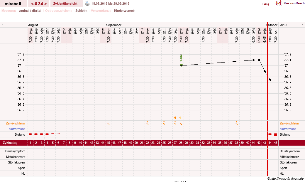 NFP-Kurve User #16685