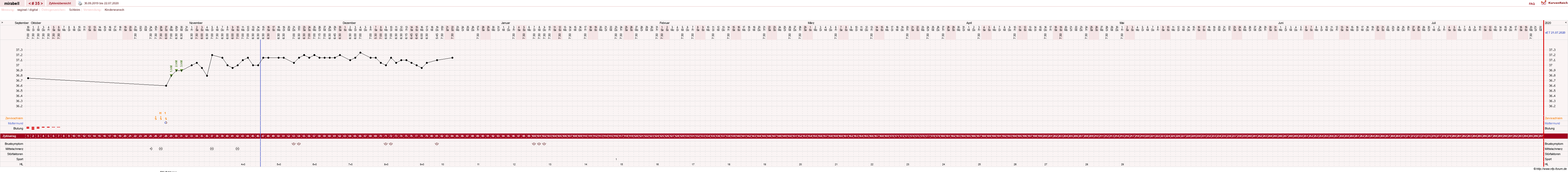 NFP-Kurve User #16685