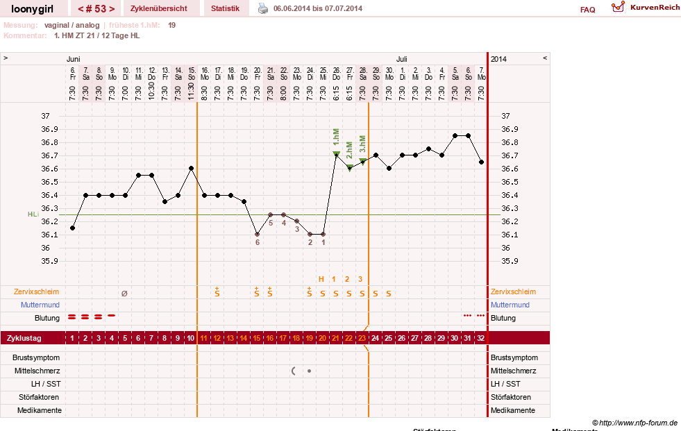 NFP-Kurve User #1681