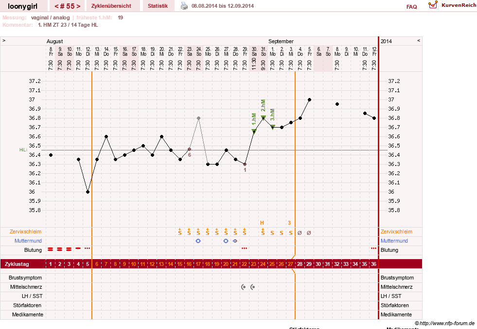 NFP-Kurve User #1681