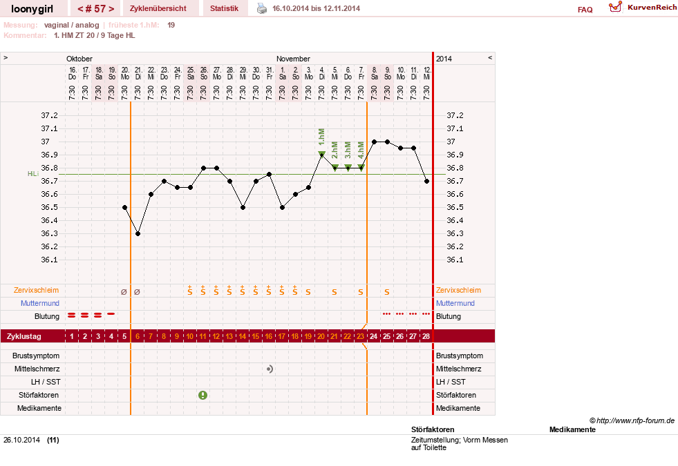 NFP-Kurve User #1681