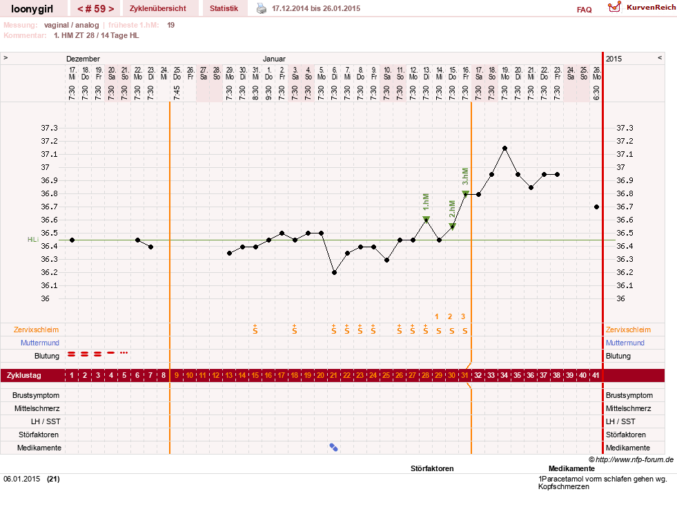NFP-Kurve User #1681