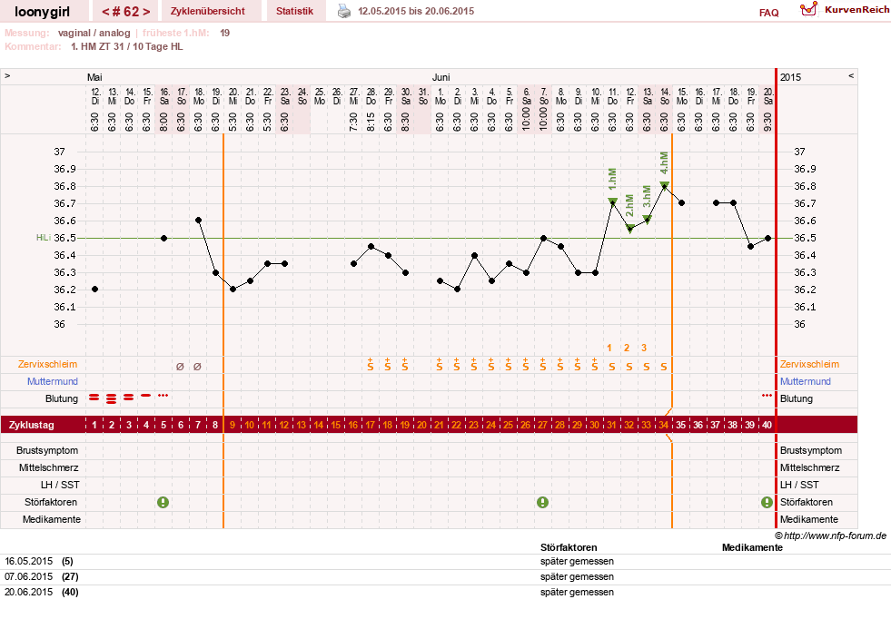 NFP-Kurve User #1681