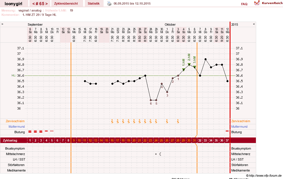 NFP-Kurve User #1681