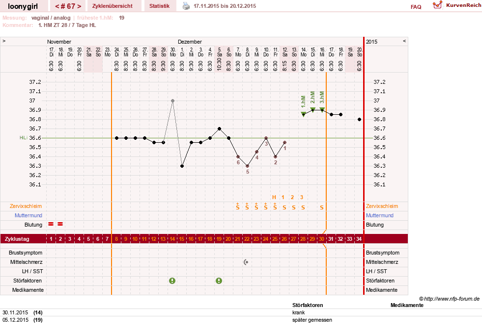 NFP-Kurve User #1681