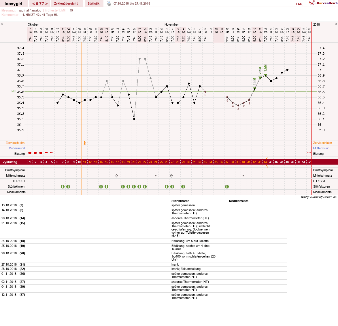 NFP-Kurve User #1681