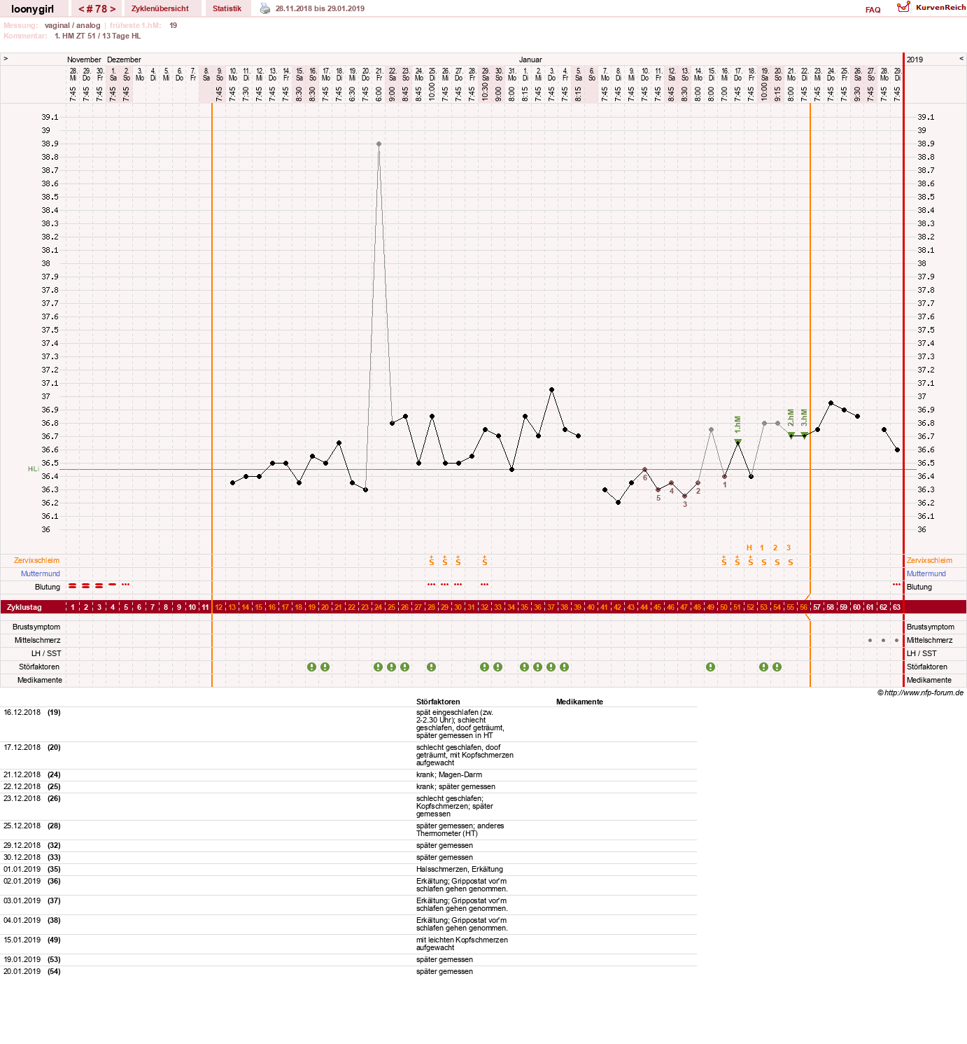 NFP-Kurve User #1681