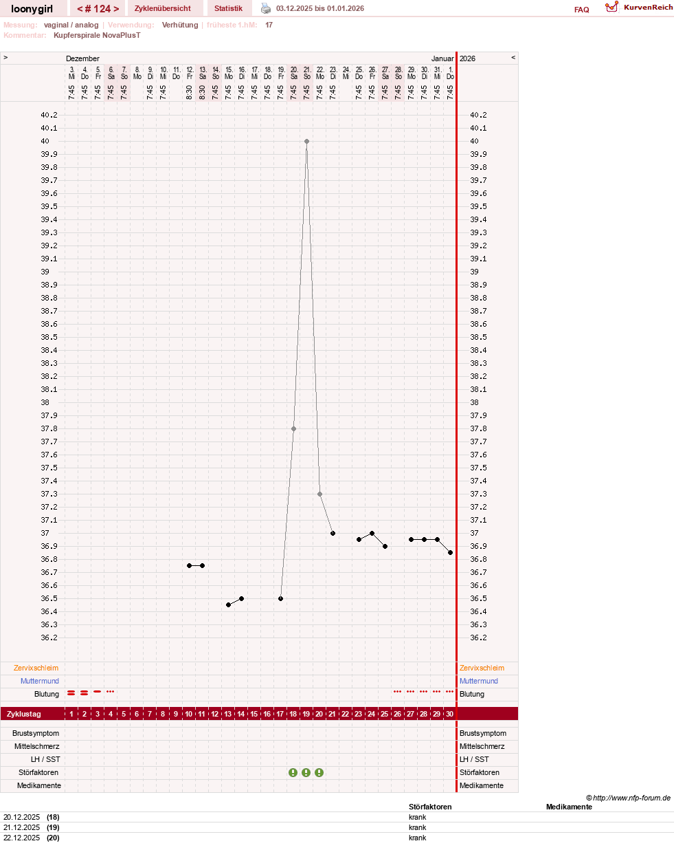 NFP-Kurve User #1681