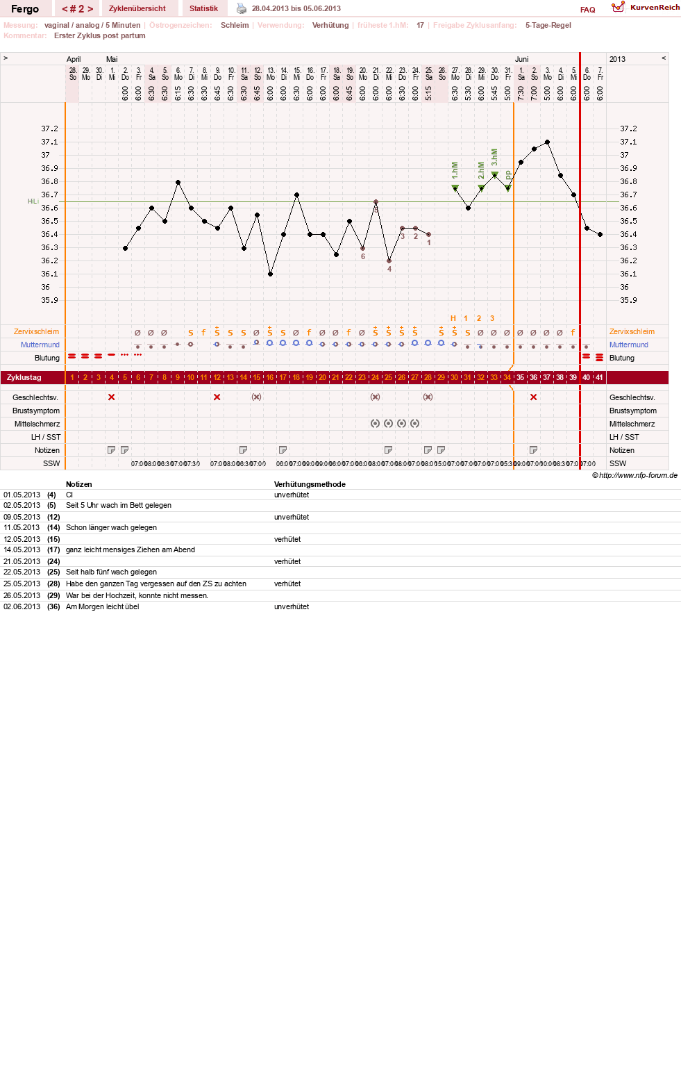 NFP-Kurve User #16851