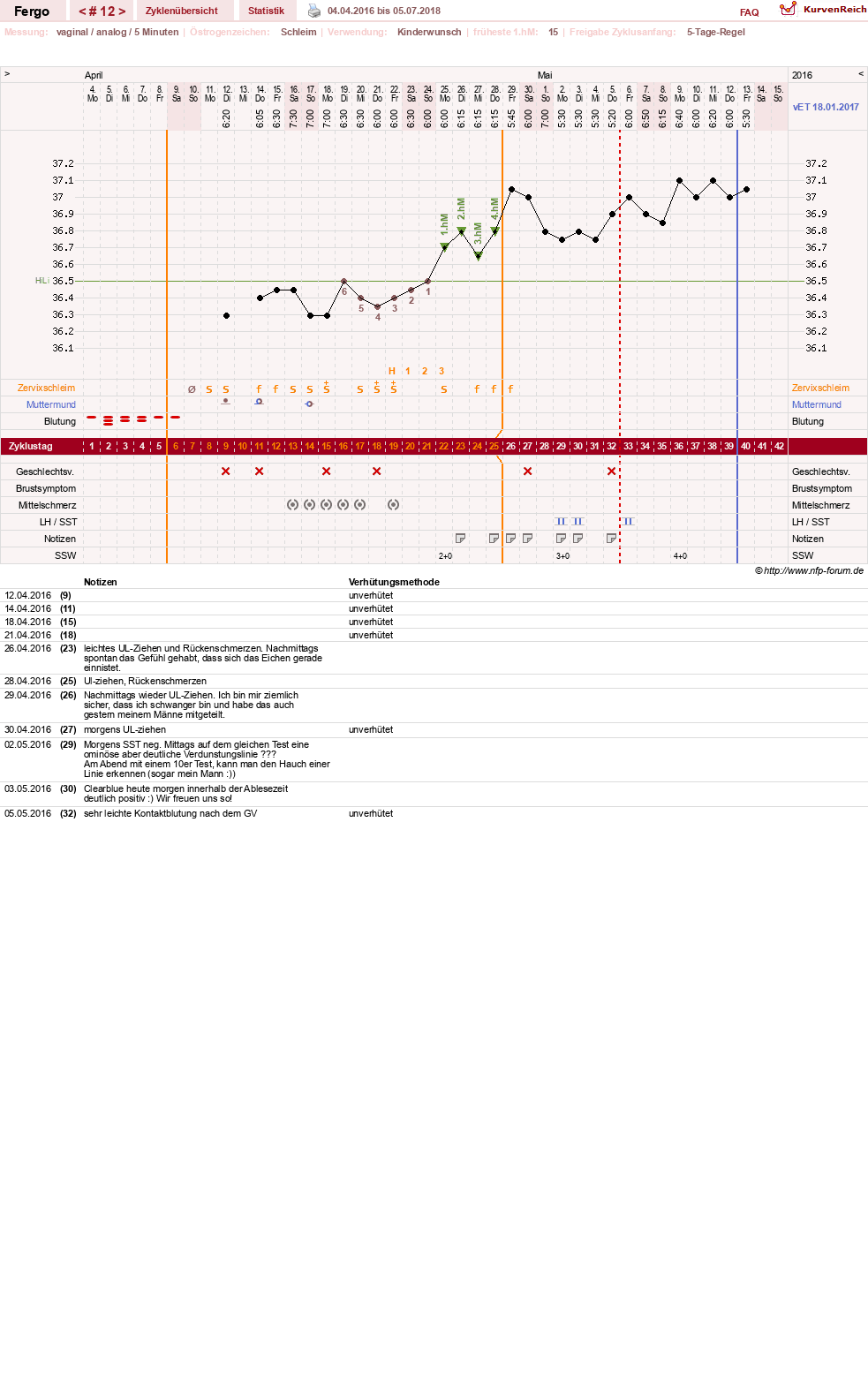 NFP-Kurve User #16851