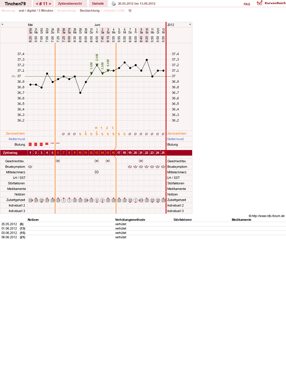 NFP-Kurve User #16990