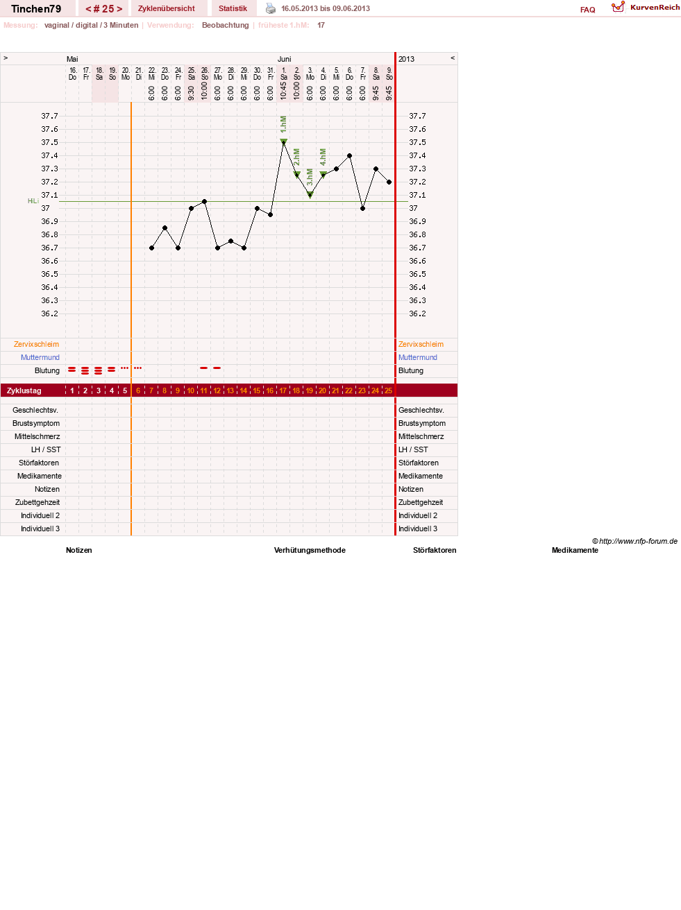 NFP-Kurve User #16990