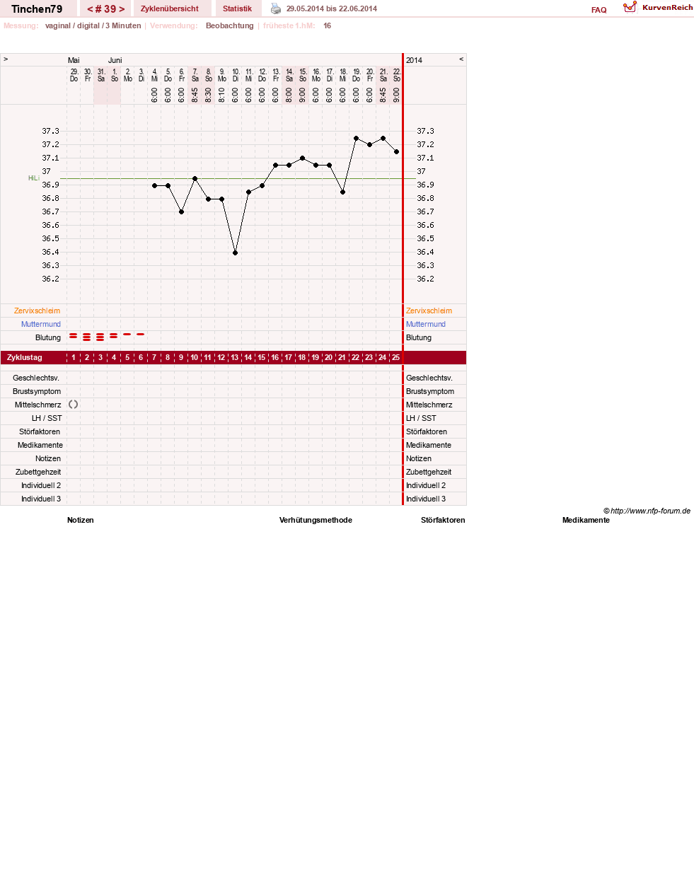 NFP-Kurve User #16990