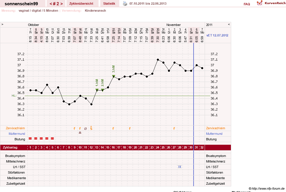 NFP-Kurve User #17031