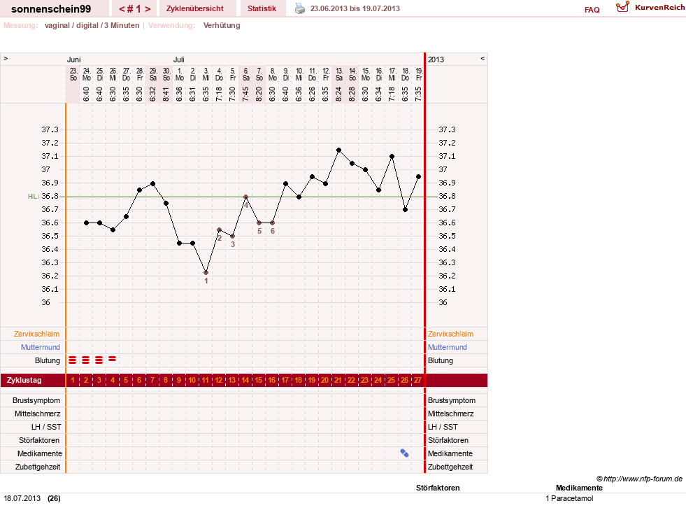 NFP-Kurve User #17031