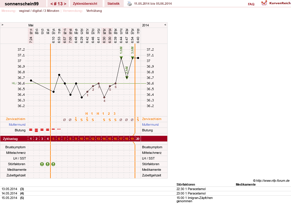 NFP-Kurve User #17031